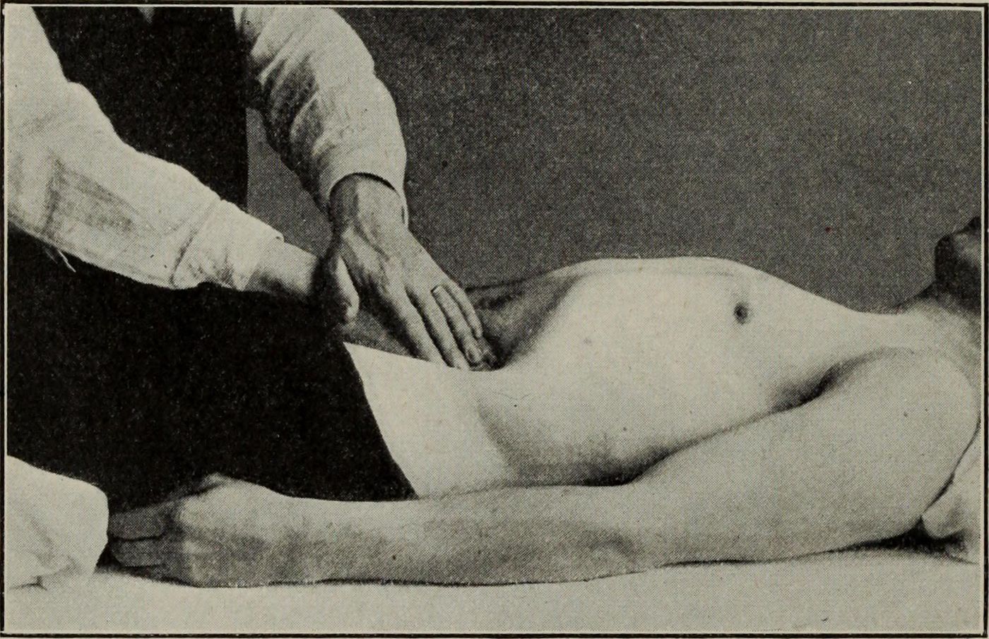 A sepia photograph from a 1917 massage textbook: a therapist's hands working the upper back and shoulders of a client seen from behind.